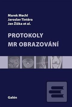 Obrázok Protokoly MR zobrazování