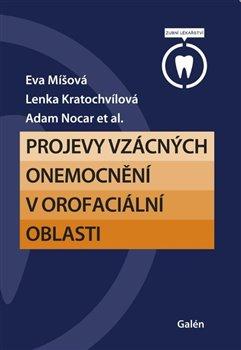 Kniha: Projevy vzácných onemocnění v orofaciální oblasti - 1. vydanie - Eva Míšová; Lenka Kratochvílová; Adam Nocar