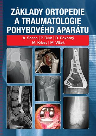 Kniha: Základy ortopedie a traumatologie pohybového aparátu - 1. vydanie - Antonín Sosna; P. Fulín; Martin Krbec
