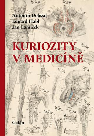 Kniha: Kuriozity v medicíně - 1. vydanie - Antonín Doležal